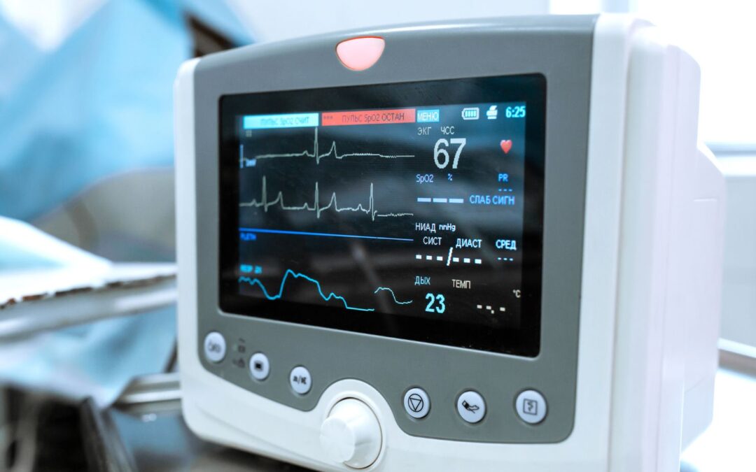 When Should You Consider Using a Cardiac Monitor in Your Lab Tests ...